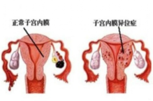 若你有这5个“表现”，可能是怀孕了!